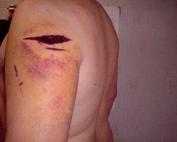 arm1[1].jpg